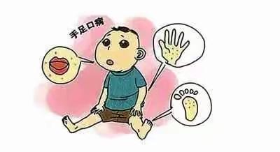 北塬镇中心幼儿园预防手足口病宣传教育