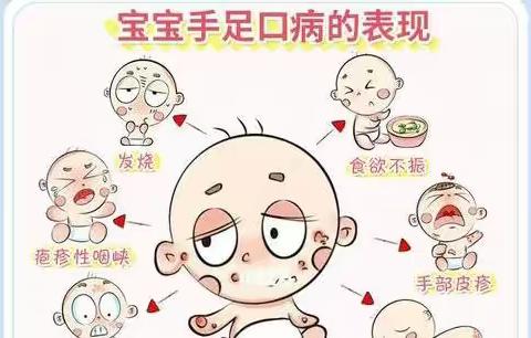 预防手足口病——维多利亚幼儿园健康教育宣传