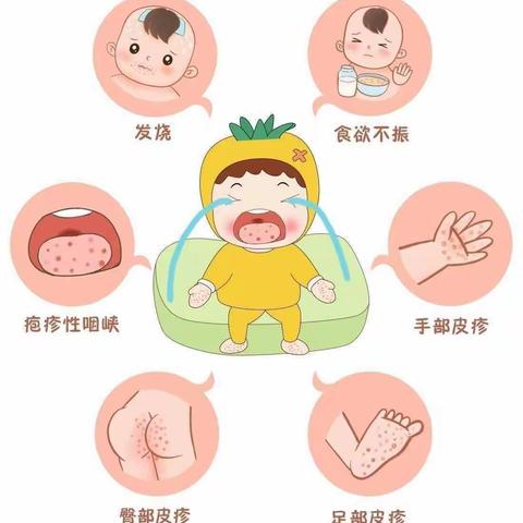 四季花开幼儿园“预防春季传染病”宣传知识手册