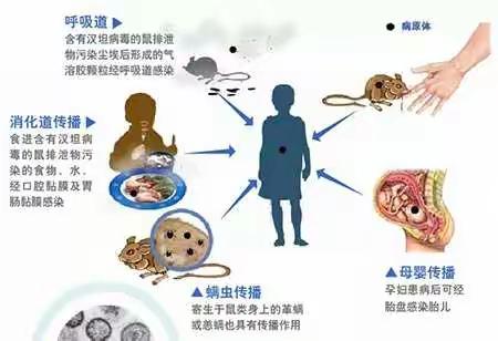 预防出血热，健康你我他——高新区第三十四幼儿园开展疾病防治工作