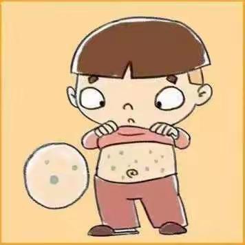 水痘预防小知识