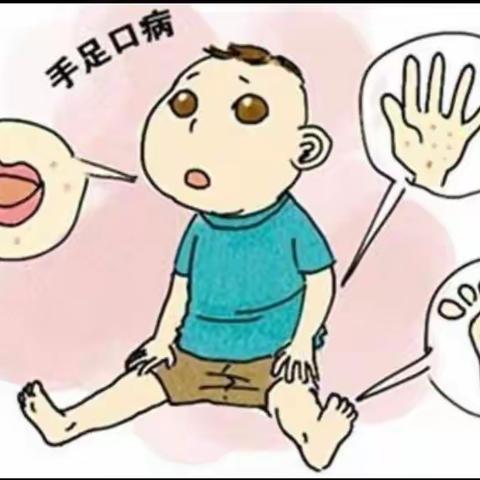 “讲卫生，远离手足口病”——西安浐灞贝乐阳光幼儿园