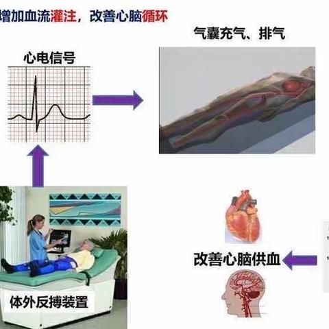 给“心脏”来一场“静态马拉松”——体外反搏疗法在心脏康复中的应用