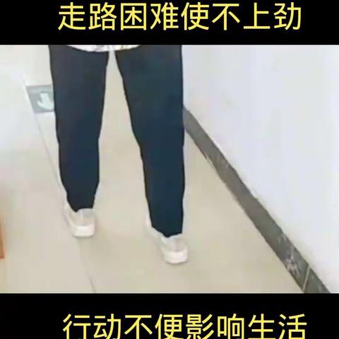 肌营养不良症状1