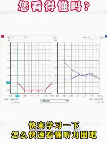 南昌耳鼻喉：拿到听力报告看不懂？两条直线表示什么意思？