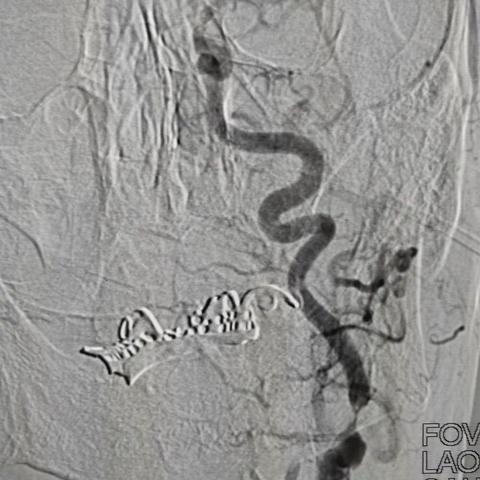 王秉前 男 68