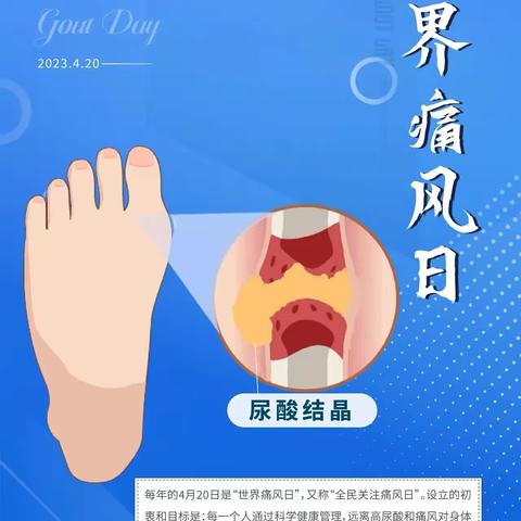 4·20世界痛风日，一起看看你不知道的痛风小知识