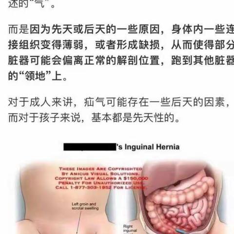 阳光森林的故事儿童课堂—疝气