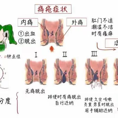 文祖社区卫生服务中心外科科普小知识，肠健康，身体才健康！