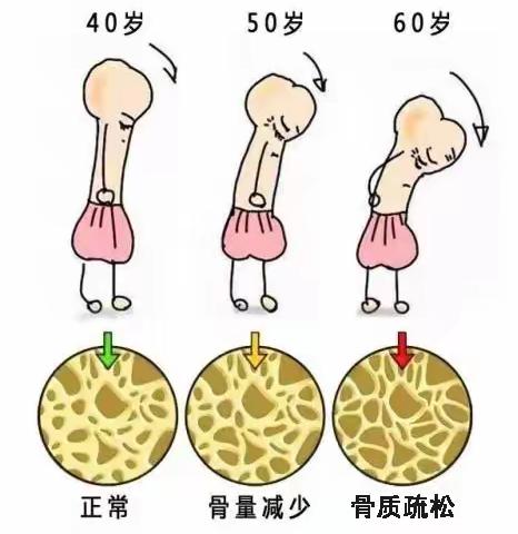 骨质疏松？一照便知！