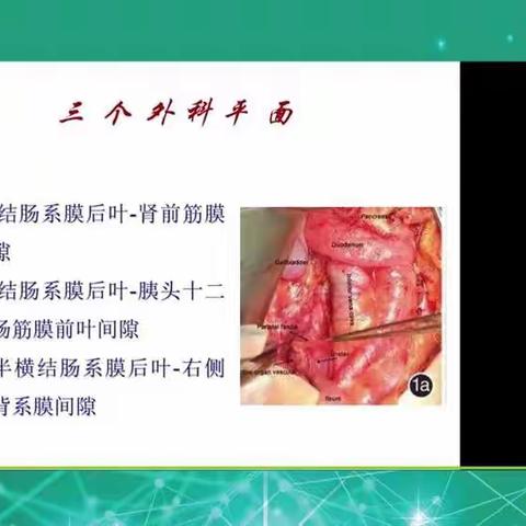 腹腔镜右半结肠