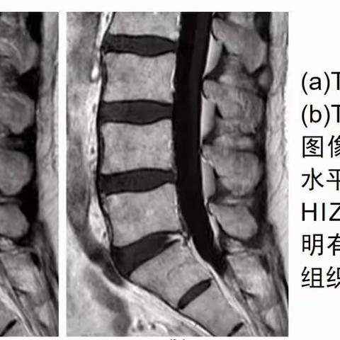 腰椎不好是什么原因呢？