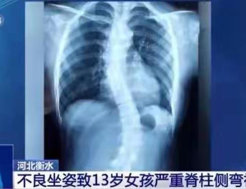 【爱子有方】落实双减政策   增强学生体质