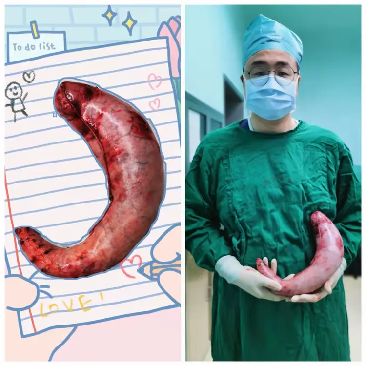 首都医科大学附属友谊医院黄牛，票贩子跑腿服务的简单介绍