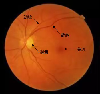 叶黄素怎么补最合适？Meinde提示你它和叶黄素酯并不同！应该这样才能高效护眼