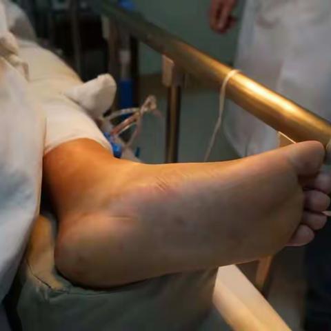 小腿毁损伤大动脉断裂危及生命 医生4小时争分夺秒“保命续肢”