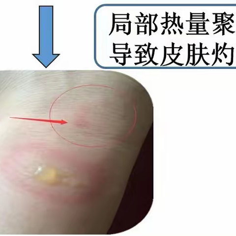 手术室健康宣教系列---“进入手术室为什么不能配带各种首饰”？