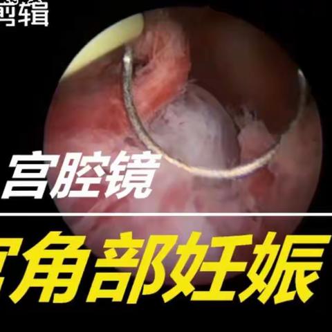 切or不切？这是个问题！