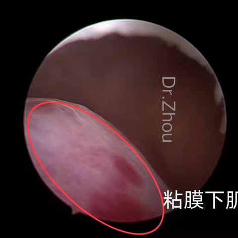 听故事说科普：切or不切？这是个问题！