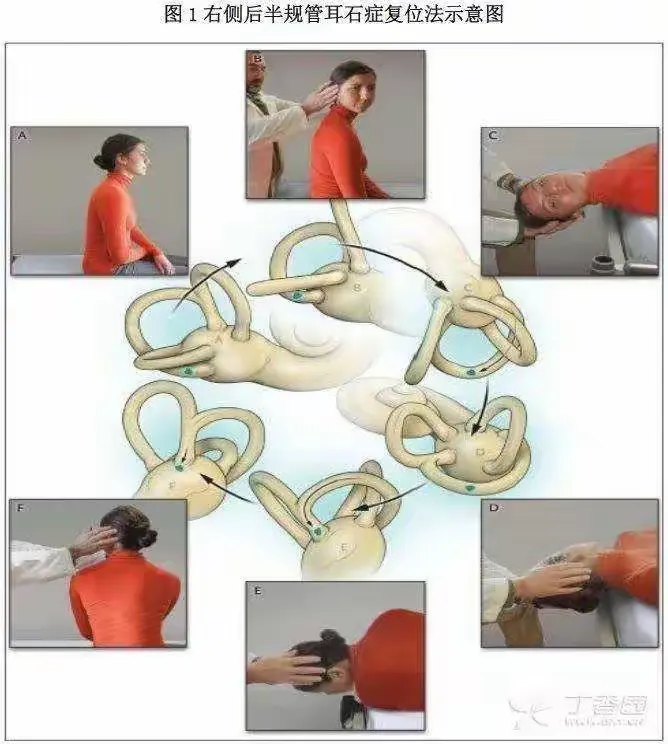 耳源性眩晕————耳石症
