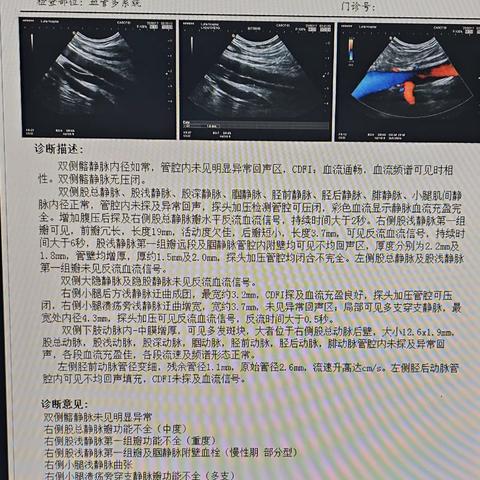 李秋生，PTS