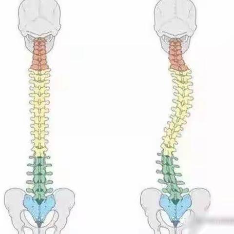 【家长关注】儿童脊柱侧弯你了解吗？