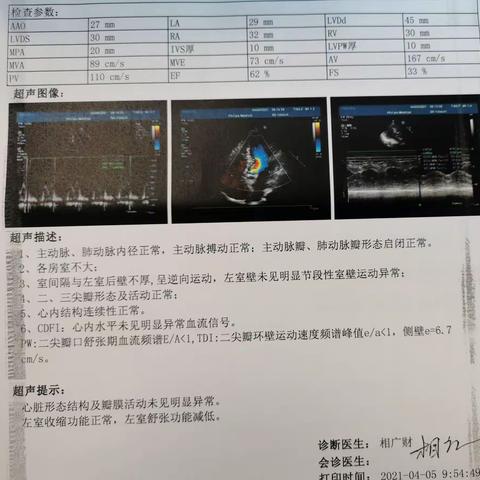 肾移植部分失功人工血管内瘘血栓形成一例