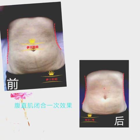 “呵护健康，绽放美丽”3月8日女神节伊川县妇幼保健产后康复科推出各项优惠活动诚邀您参加！