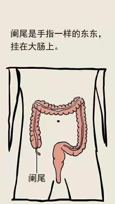 阑尾炎的那点事