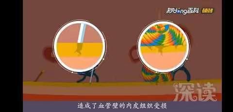 心肌梗死不要怕，及时就医最重要