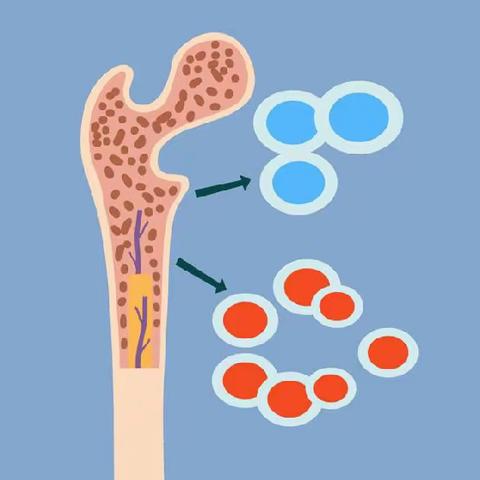 多发性骨髓瘤抗BCMA疗法Blenrep在美撤销批准