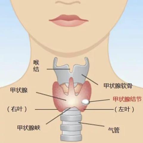 普外科成功开启腔镜下甲状腺手术新征程