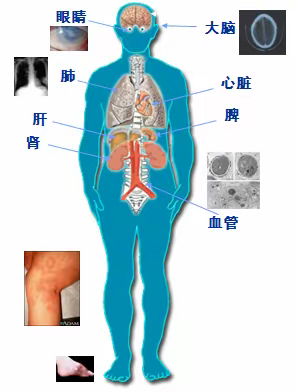 检验科新开展项目：真菌（1-3）-β-D葡聚糖检测（G实验）