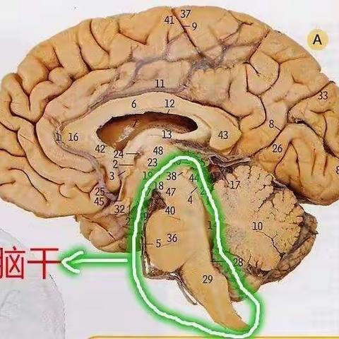 脑干出血，滴滴致命—精心医护，奇迹发生