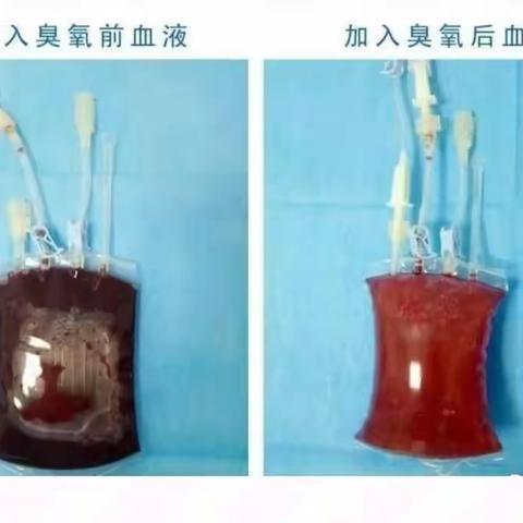 三氧小课堂:三氧自体血回输疗法功效