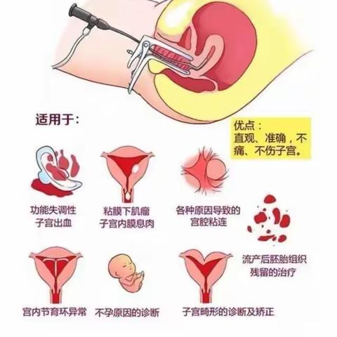 心心念的STORZ宫腔镜冷刀动力系统和CAMPO经阴道内镜已妥妥的，各位小主们让我们相约在渭北中心医院！