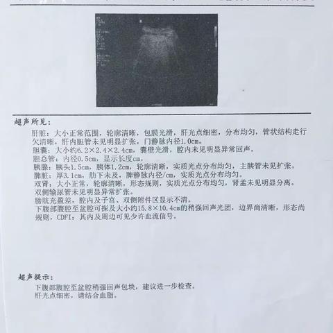 我院妇产科成功完成1例罕见巨大子宫肌瘤切除手术