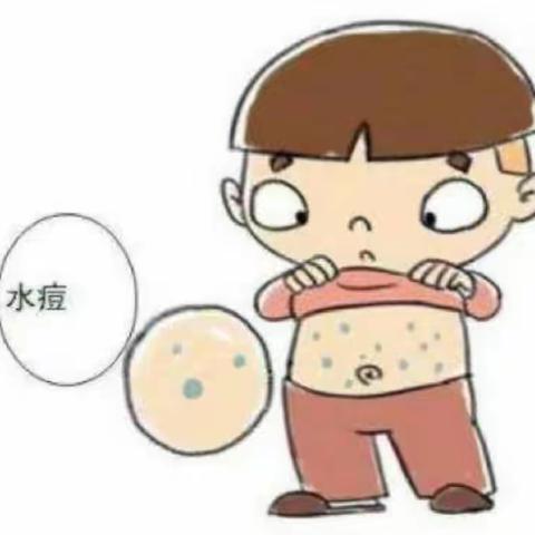 【均中幼健康教育科普】预防水痘我知道！