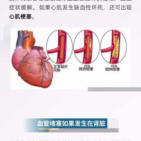 血管变“老”，全身变老！6招延缓血管老化