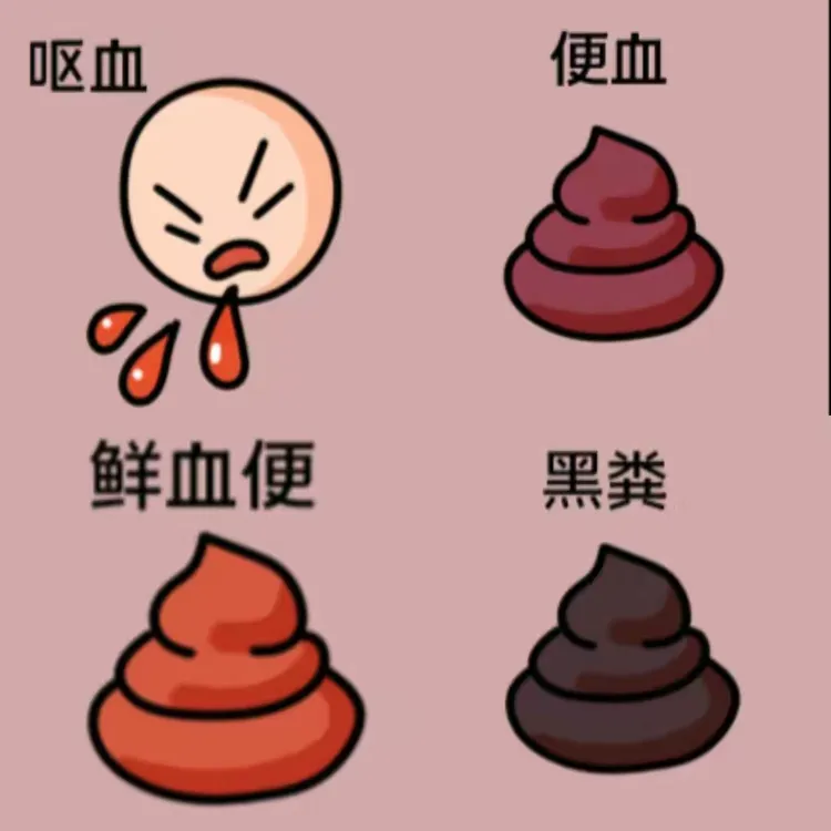 血液经过肛门排出时,表现为黑便和便血