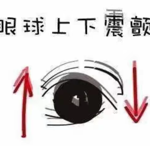 眼球震颤是什么原因？