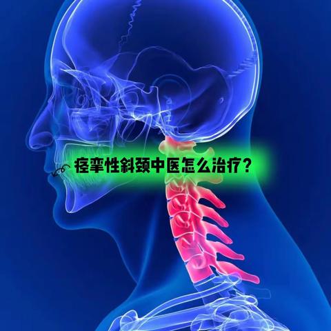 治疗痉挛性斜颈刻不容缓，浅谈痉挛性斜颈