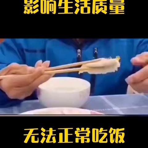 帕金森