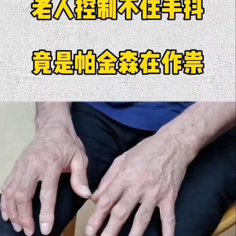 帕金森综合征