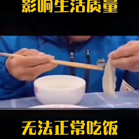 帕金森