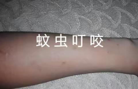 呼吸困难的渐冻症患者最怕感冒，这是为什么?怎么做好防范?