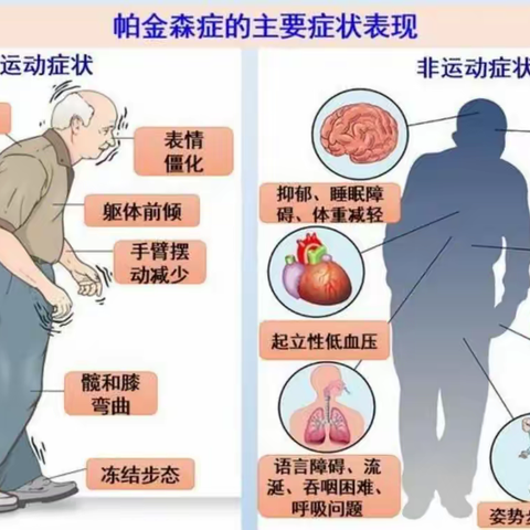 帕金森不要钱的几种缓解方法，学会受益终生