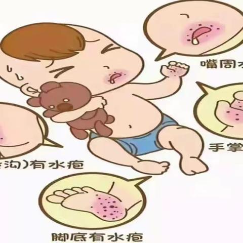手足口病家庭护理小常识