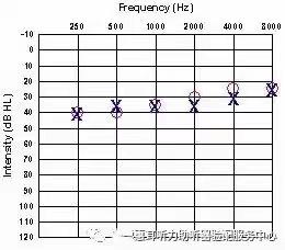 为何人们不重视轻度听力障碍