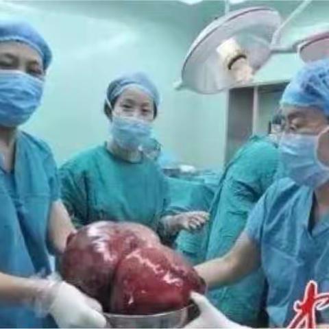 “妇科第一瘤”子宫肌瘤怎么来的？ 可怕！